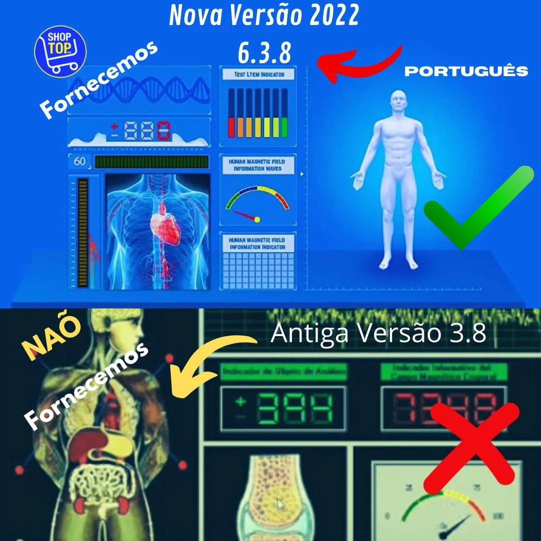analisador_biorressonancia_quantum_versao_portugues_tens_79_3_cabed98b3ec46c5f448036242932c9ea