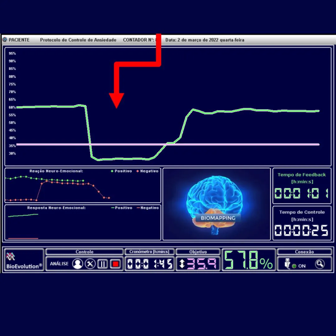 equipamento_analisador_neurometria_v6_bioscan_prime_ia_inteligencia_artificial_cerebro_3d_relatorios_371_6_9bbec8976e9586f3480e1a54d75ba239